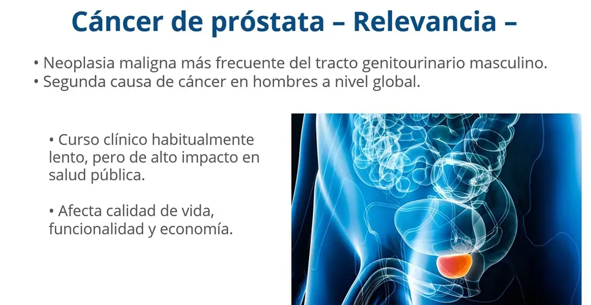 Urgente detectar a tiempo el cáncer de próstata: UNAM y especialistas alertan sobre diagnóstico tardío en México