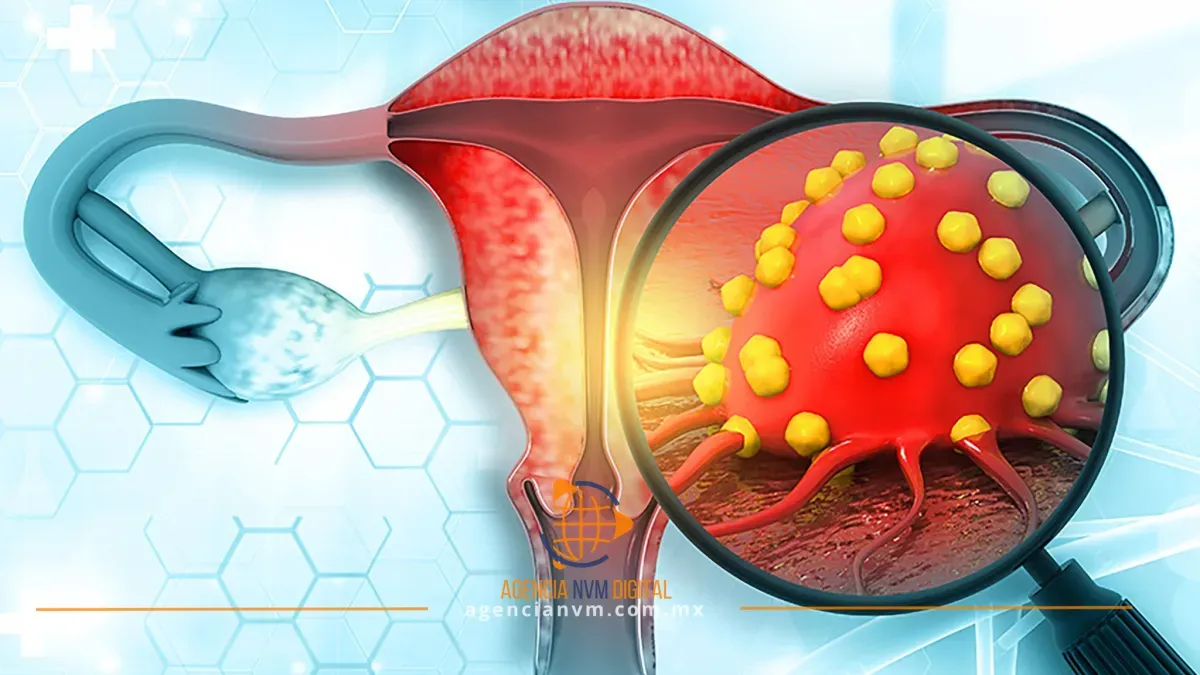 Cáncer cervicouterino: la detección temprana salva vidas